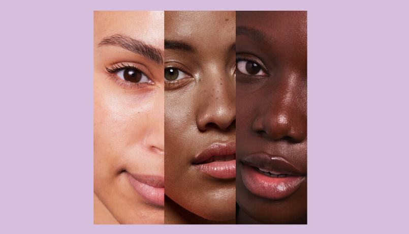 Skin Phototypes 4, 5 and 6