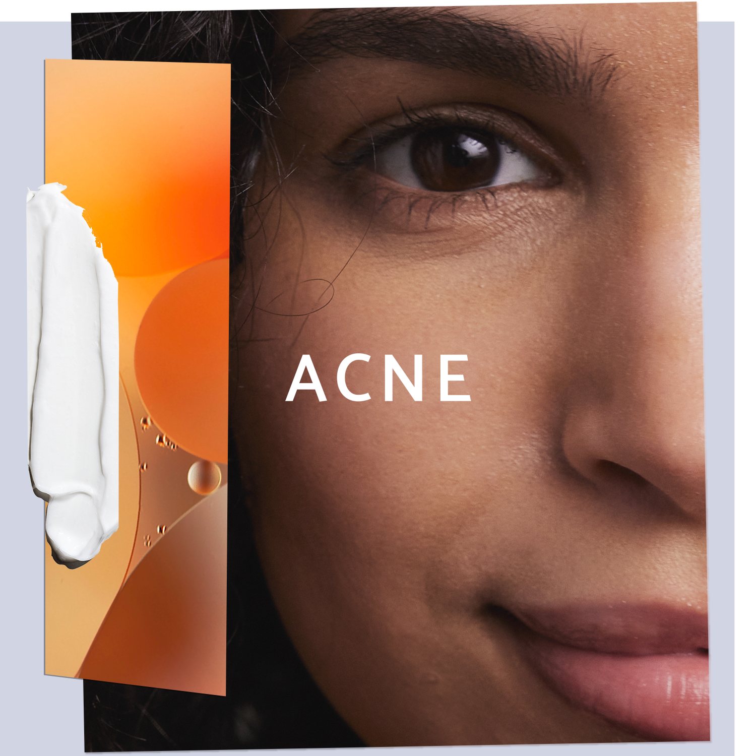 Skincare for Acne 