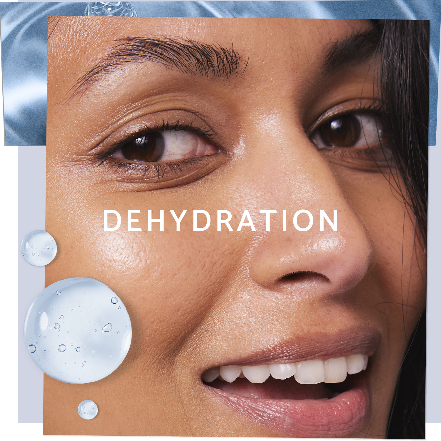 Skincare for Dehydration 