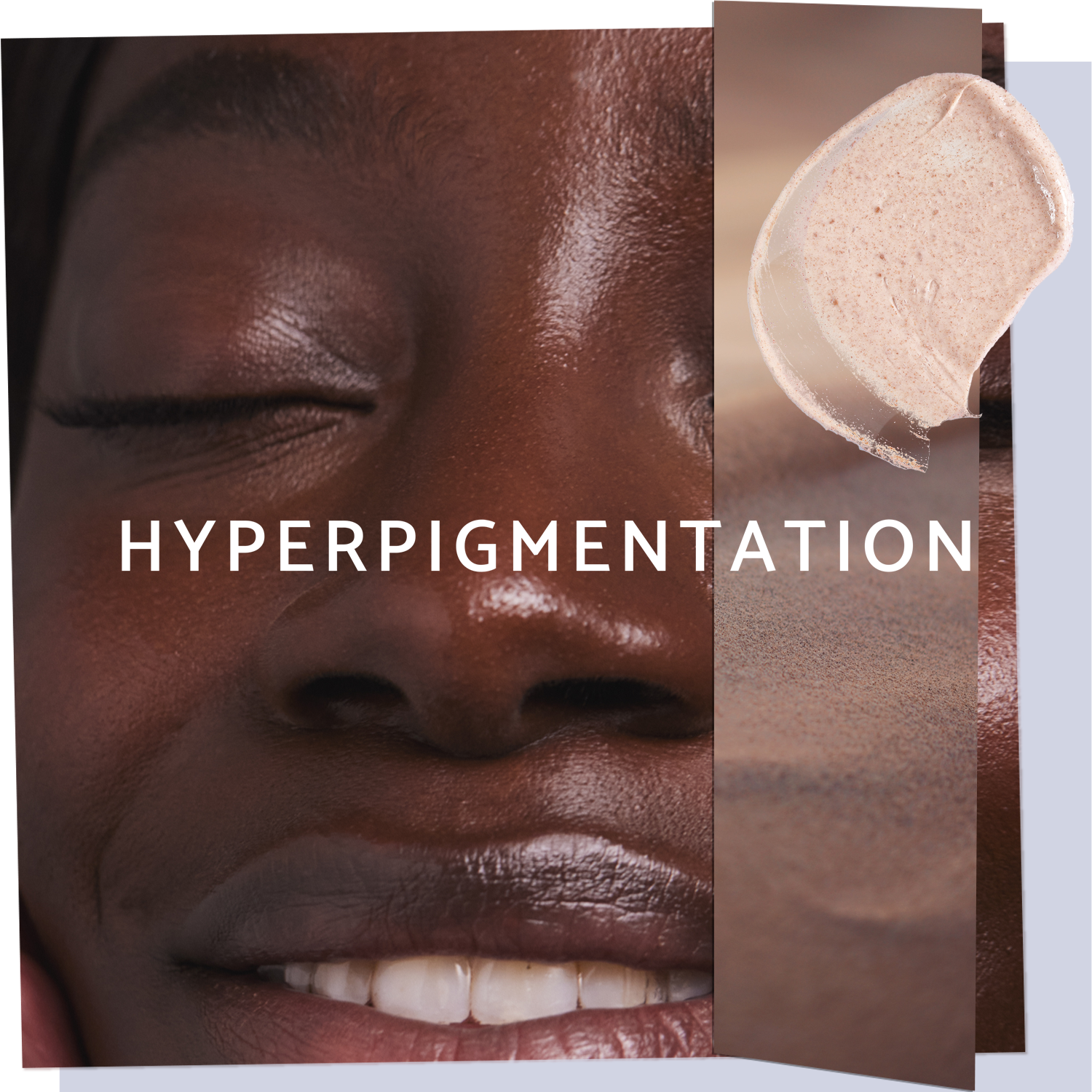 Skincare for Hyperpigmentation 