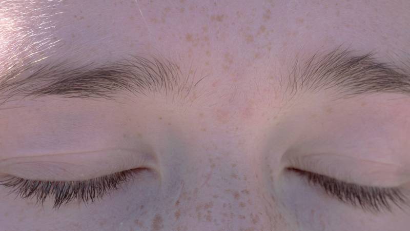 hyper-pigmentation-cream