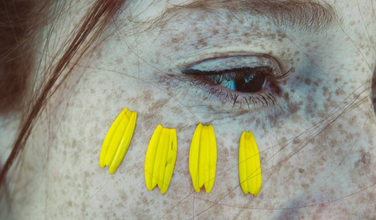 hyper-pigmentation-cream