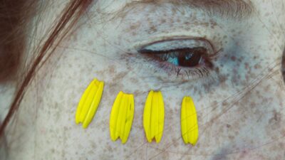 hyper-pigmentation-cream