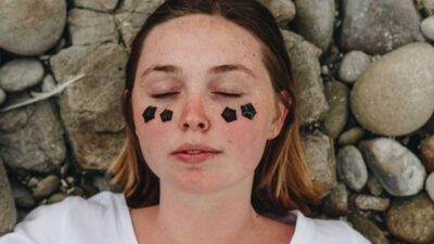 large-pores-blackheads