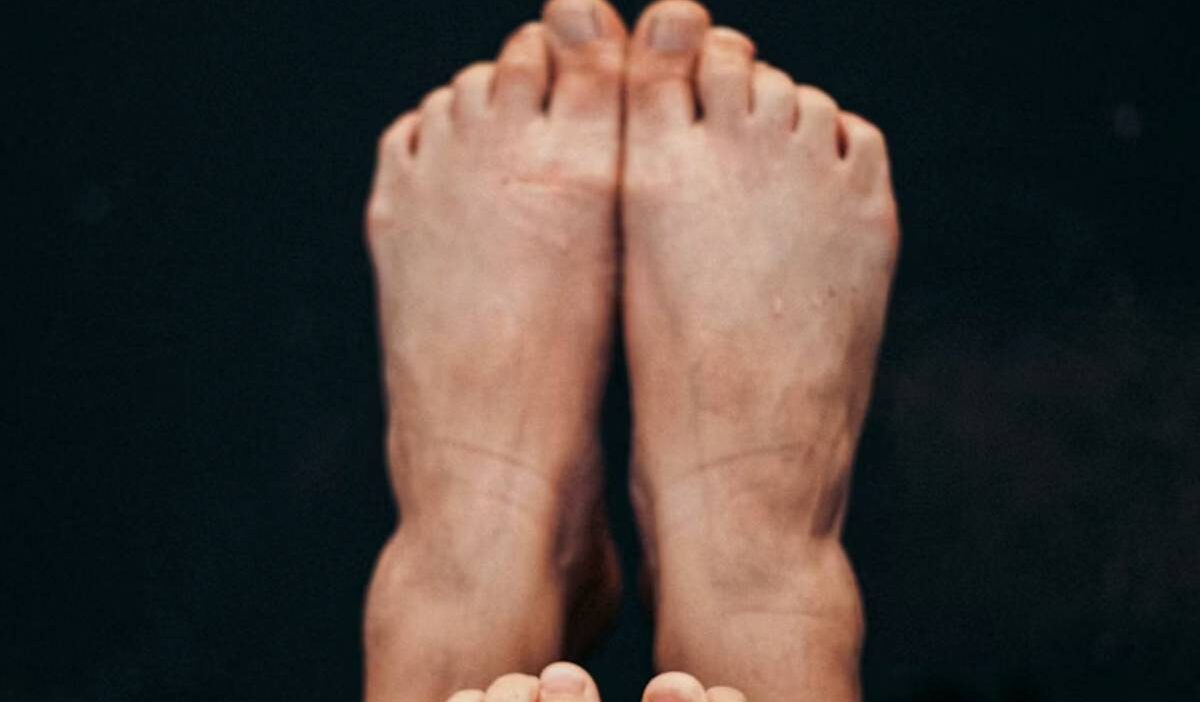 why-are-my-feet-peeling