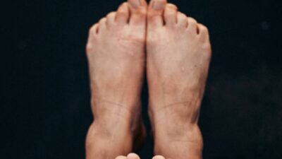 why-are-my-feet-peeling