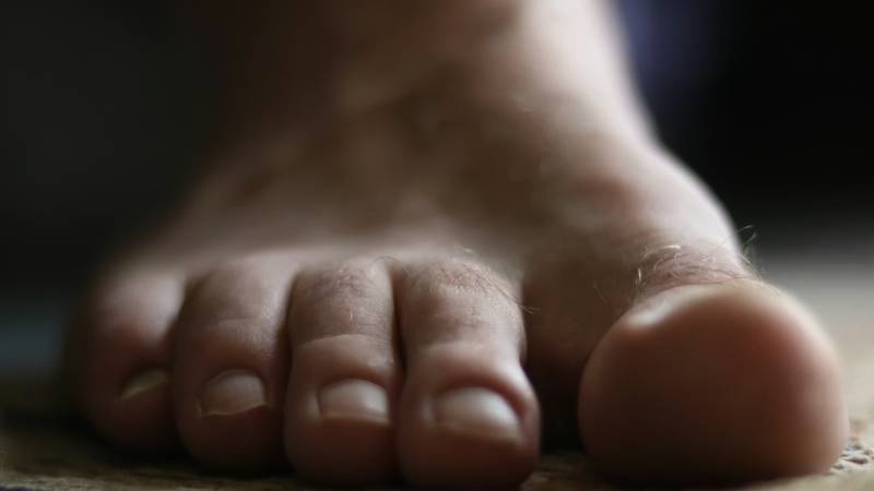 athletes-foot-vs-dry-skin