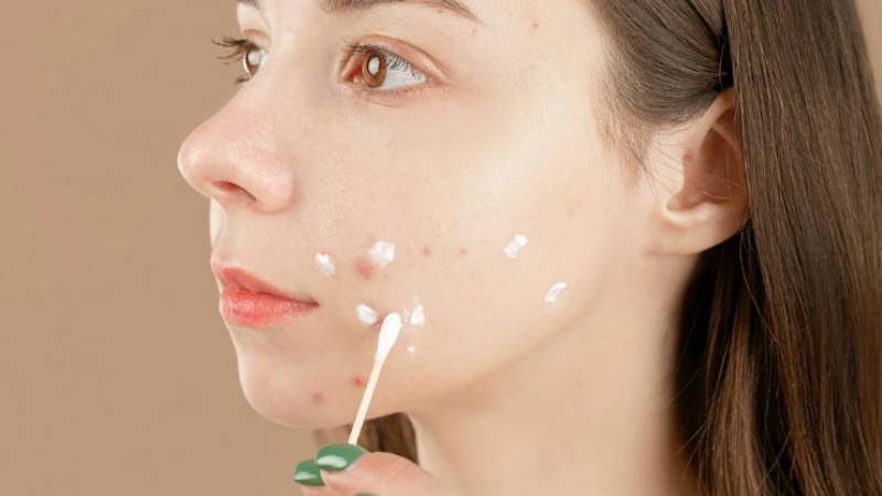 best-moisturizer-for-oily-acne-prone-skin