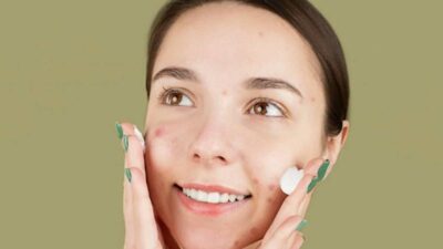 best-moisturizer-for-oily-acne-prone-skin