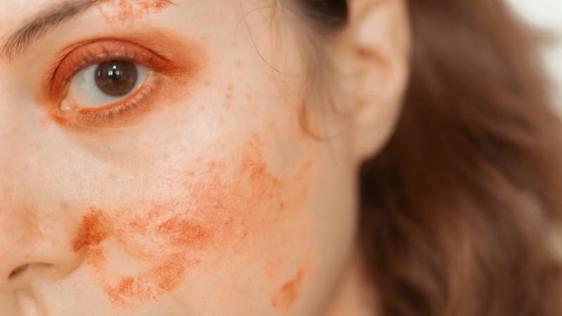 how-to-get-food-coloring-off-skin