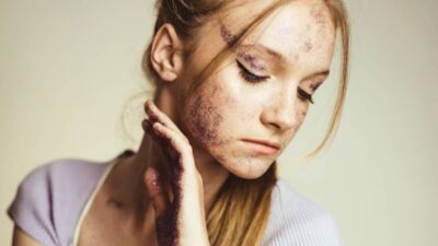 how-to-get-food-coloring-off-skin