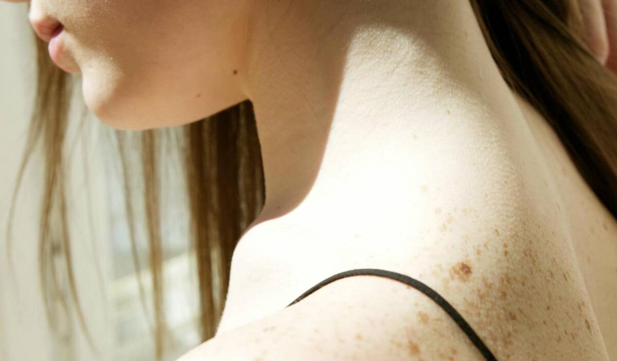 how-to-tighten-neck-skin