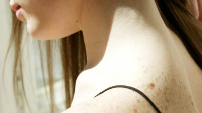 how-to-tighten-neck-skin