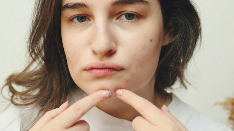 tiny-black-dots-on-skin-suddenly