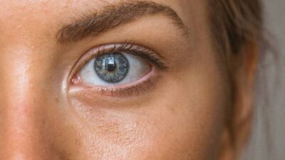 why-is-my-face-so-oily